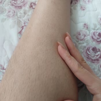 Küçükköy Özel Bilge Hastanesi'nde Lazer Epilasyon Hizmeti