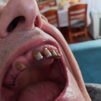 Ev Diş Polikliniği Babamın 3 Yıldır Maddi Manevi Mağdur Edildik