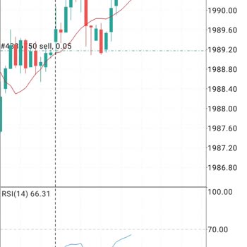 Abn Markets Çekim İzni Vermediler