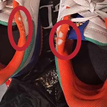 Adidas Ayakkabı Bizi Mağdur Ediyor, Çözüm Üretmiyor.!