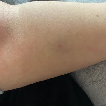 Akdeniz Üniversitesi Hastanesi Engelli Hastaya Karşı Tutumunuz Ve Ameliyat Düzeniniz