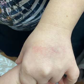 Akdeniz Üniversitesi Hastanesi Engelli Hastaya Karşı Tutumunuz Ve Ameliyat Düzeniniz