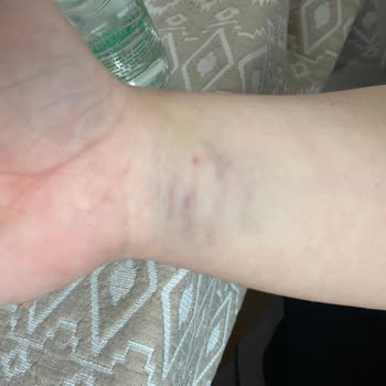 Akdeniz Üniversitesi Hastanesi Engelli Hastaya Karşı Tutumunuz Ve Ameliyat Düzeniniz