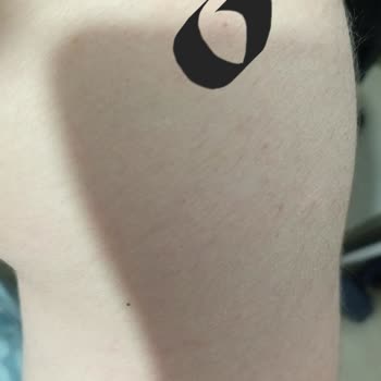 Nokta Eczanesi (Maltepe) Aşıyı Yanlış Yere Yapmak