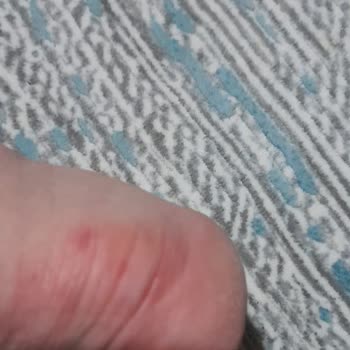 Puma Marka Ayakkabı Topuklarımı Mahvetti