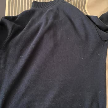 Tommy Hilfiger Kaz Tüyü Mont Tüy Dökme Sorunu