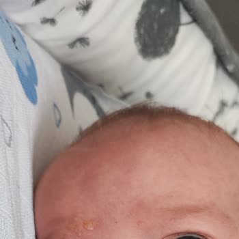 Mustela Şampuan Yenidoğan Alerji