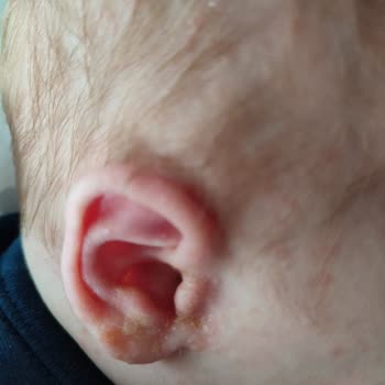 Mustela Şampuan Yenidoğan Alerji