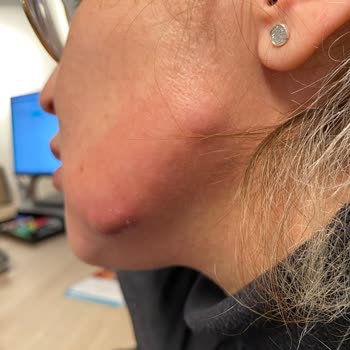 Luxen Wellness Clinic 'de Asılsız Beyan Ve Faturasız İşlem Sorunu