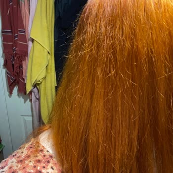 Saçlarım Yandı Elseve Saç Bakım Suyu Yüzünden