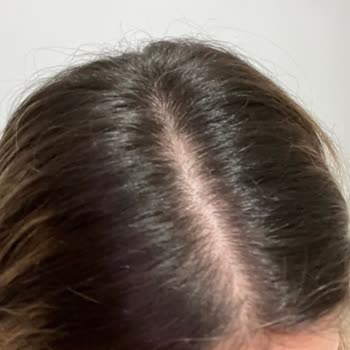 Zafer İdris Kuaför Beşiktaş'taki Kuaföre Saçımı Boyattım Beni Hayal Kırıklığına Uğrattı!