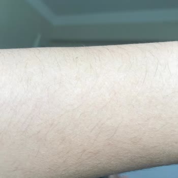 Pınar Kutlar Kalıcı Makyaj Stüdyosu Tüylerim Dökülmedi Mağdurum