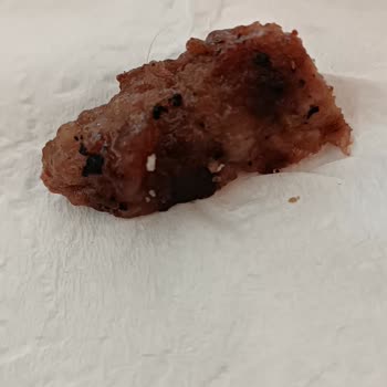 Köfteci Yusuf Hijyenik Olmayan Köfteleri (kıl)