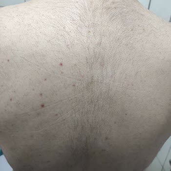 E'liva Beauty (Kayseri) Eliva Beauty Kayseri Firması Şikayetçiyim