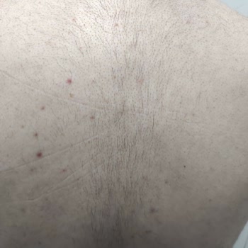 E'liva Beauty (Kayseri) Eliva Beauty Kayseri Firması Şikayetçiyim