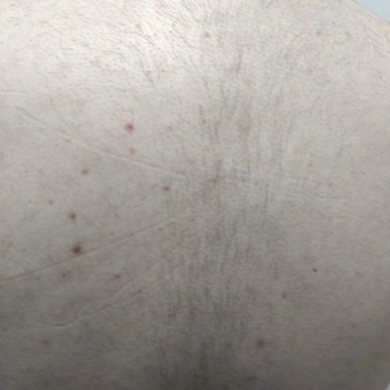 E'liva Beauty (Kayseri) Eliva Beauty Kayseri Firması Şikayetçiyim