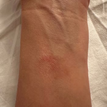 Apple Watch 8 S Bileğimi Yaktı