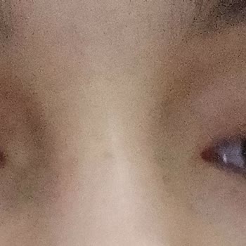 Gratis Beaulis Close İt Kapatıcı