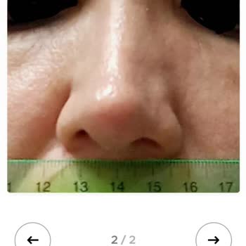 Op. Dr. Emre İlhan Eşimi Ortada Bıraktı