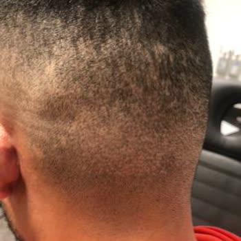 Rhc Clinic Hayatımın En Büyük Hatası