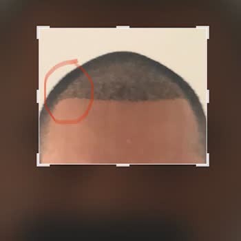 Rhc Clinic Hayatımın En Büyük Hatası