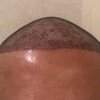 Rhc Clinic Hayatımın En Büyük Hatası