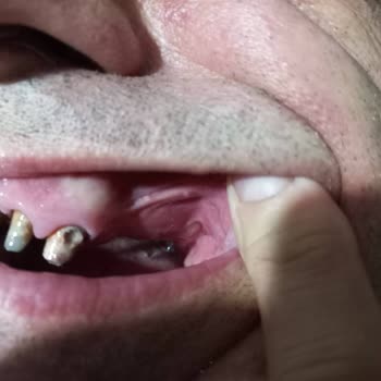 Ev Diş Polikliniği Mağduriyeti