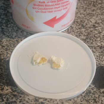 Evolvia Bebek Maması İçinden Çıkan Yabancı Madde