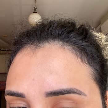 Fatma Çakmak Vizyon Güzellik - Estetik Microblading İşlemi Çok Kötü Yapıldı