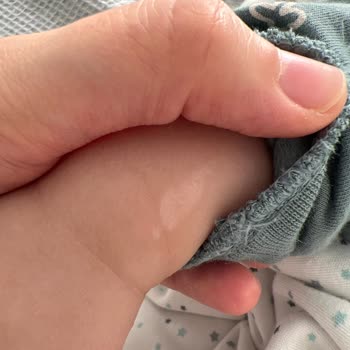 Medical Park Hastanesi Doğum Sürecim, Bebeğimde Tırnak İzleri, Bende Kalıcı İzler Bıraktınız!