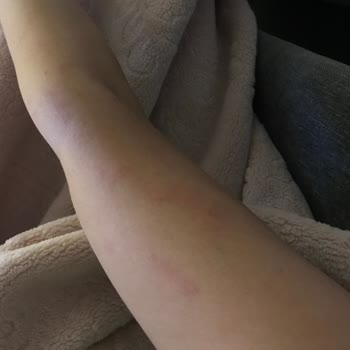 Suit Güzellik Merkezleri Mersin Kolumu 2 Kez Yaktılar