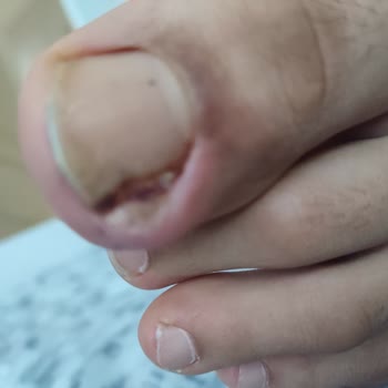 Safa Hastanesi Cildiye Polk Şikayet