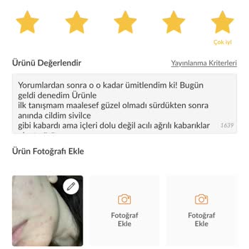 Trendyol Nuwa Vitamin C Renk Tonu Eşitleyici Serum Alerji Yaptı!