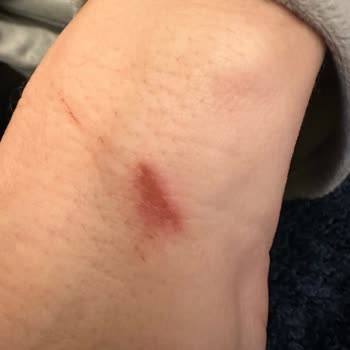 İzmir Ephesus Hitit Hotel'de Yaşanan Kaza! / Jolly Tur