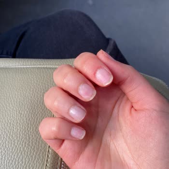 Narges Beauty Center'de Protez Tırnak Çıkartma İşleminde Tırnak Hasarı