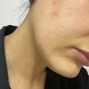 Dermoskin Be Bright Krem Zehirledi