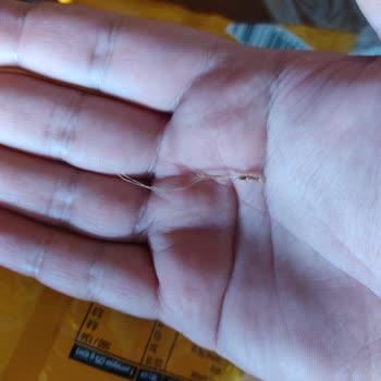 Doğuş Çay Kıl Çıktı Hijyen Sorunu