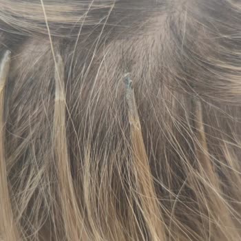 The Hair Lab Medical Kaynak Mı! Micro Kaynak Mı!