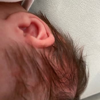 Nestlé İyi Büyüsün İyi Yaşasın Sma Optipro Alerji Yaptı