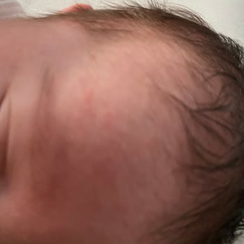 Nestlé İyi Büyüsün İyi Yaşasın Sma Optipro Alerji Yaptı