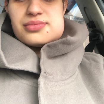 Özel İşçievleri Ağız Ve Diş Sağlığı Polikliniği Dişime Dolgu Yapıyım Derken Mahvetti