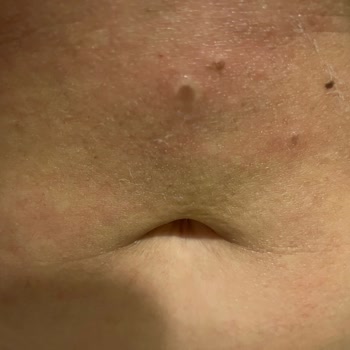 Remove Tüy Sarartıcı Krem Yanık Ve Leke Yaptı!