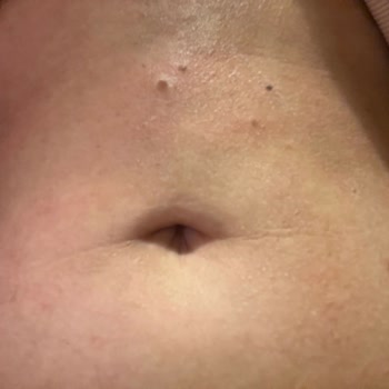 Remove Tüy Sarartıcı Krem Yanık Ve Leke Yaptı!