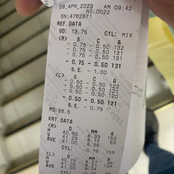 Era Göz Hastanesi'nde No Touch Göz Ameliyatı Oldum Hala Astigmatım Geçmedi