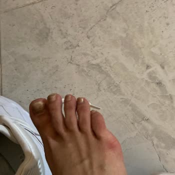 Sneaks Up Sorunlu Ürün Satış