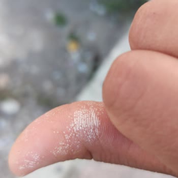 Kosla Leke Çıkarıcı Elime Zarar Verdi Elimi Yaktı