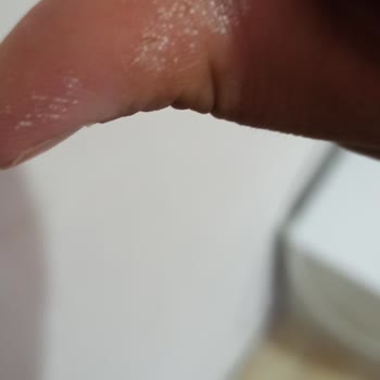 Kosla Leke Çıkarıcı Elime Zarar Verdi Elimi Yaktı