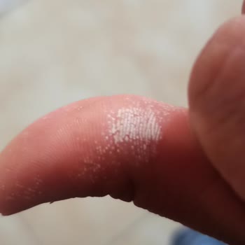 Kosla Leke Çıkarıcı Elime Zarar Verdi Elimi Yaktı