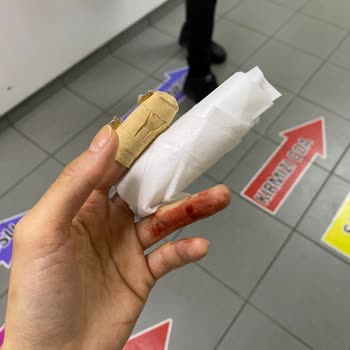 Evidea Yaralanma Sonrasında Mağaza Tarafından Bir Kez Olsun Aranmamak...