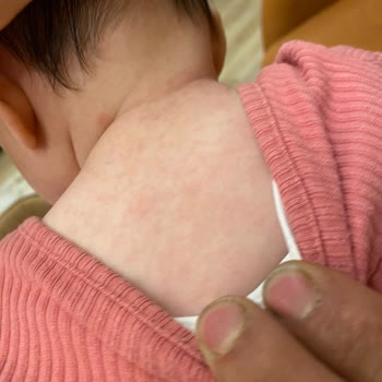 Papatya Eczanesi (Beylikdüzü) Tarihi Geçmiş Krem Satan Eczane